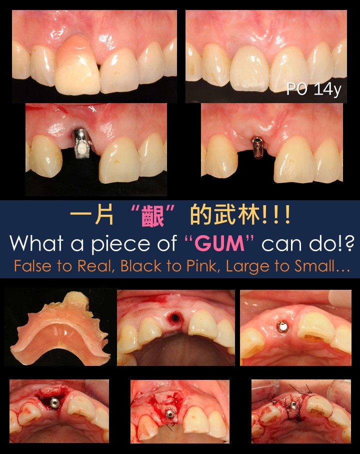 blog-post