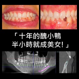 blog-post
