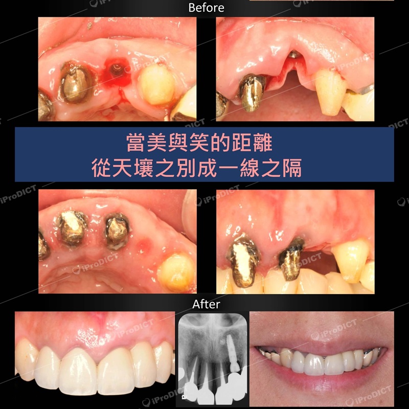 blog-post