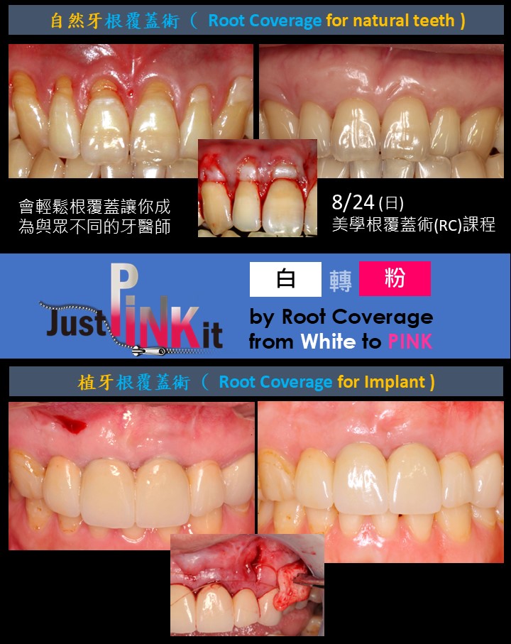 blog-post